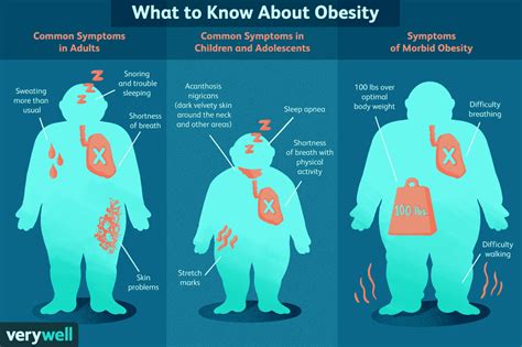 obease|Obesity: What It Is, Classes, Symptoms, Causes